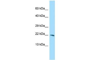 WB Suggested Anti-CXorf40A Antibody Titration: 1.