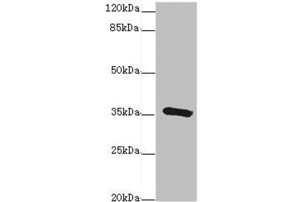 GDA anticorps  (AA 165-454)