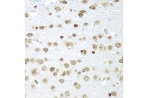 Immunohistochemistry of paraffin-embedded mouse brain using S antibody (ABIN1682621, ABIN3018891, ABIN3018892 and ABIN6220612) at dilution of 1:100 (40x lens). (SAP18 anticorps  (AA 21-172))