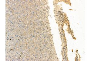 ABIN7094515 and ABIN7098564 at 1/100 staining Rat brain tissue by IHC-P.