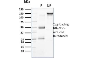 SDS-PAGE Analysis Purified Cytokeratin 18 Mouse Monoclonal Antibody (KRT18/834).