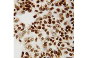 Anti-CTBP2 antibody, ICC ICC: HELA Cell