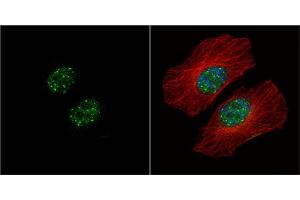 ICC/IF Image HMBOX1 antibody [N3C3] detects HMBOX1 protein at nucleus by immunofluorescent analysis. (HMBOX1 anticorps)