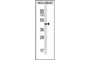 Western blot analysis of HAPLN3 Antibody (Center) in MDA-MB453 cell line lysates (35ug/lane). (HAPLN3 anticorps  (Middle Region))