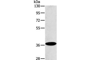 Western Blot analysis of Raji cell using ACMSD Polyclonal Antibody at dilution of 1:400 (ACMSD anticorps)
