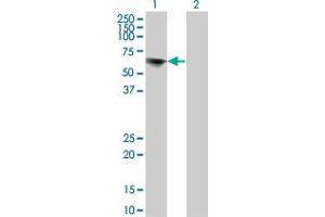 Western Blot analysis of TOE1 expression in transfected 293T cell line by TOE1 monoclonal antibody (M02), clone 1C12. (TOE1 anticorps  (AA 1-510))