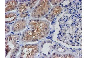Immunohistochemical staining of paraffin-embedded Human Kidney tissue using anti-PTPN7 mouse monoclonal antibody. (PTPN7 anticorps)