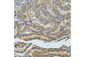 Immunohistochemistry of paraffin-embedded rat kidney using PDCD6IP antibody (ABIN5971240) at dilution of 1/100 (40x lens). (ALIX anticorps)
