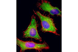 Immunofluorescent analysis of 4 % paraformaldehyde-fixed, 0.
