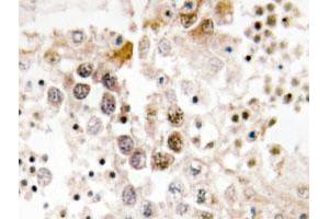 Immunohistochemical analysis of paraffin-embedded human testis tissue using FOXL1 polyclonal antibody .