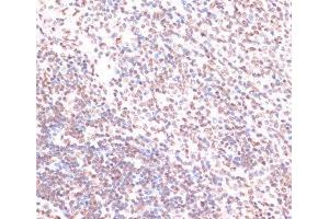 Immunohistochemistry of paraffin-embedded Rat spleen using Phospho-ERK1(T202/Y204)/ ERK2(T185/Y187) Polyclonal Antibody at dilution of 1:100 (40x lens).