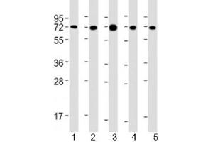Western blot testing of human 1) MCF-7, 2) PC-3, 3) COS-7, 4) DU-145 and 5) SK-BR-3 cell lysate with USP2 antibody at 1:2000. (USP2 anticorps  (AA 1-258))