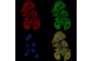 IREB1 Mouse Monoclonal Antibody staining Hela cells by IF/ICC. (Aconitase 1 anticorps)