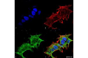Immunocytochemistry/Immunofluorescence analysis using Mouse Anti-GIT1 Monoclonal Antibody, Clone S39B-8 . (GIT1 anticorps  (AA 375-770) (FITC))
