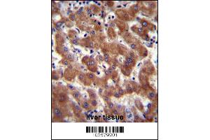 Androgen Receptor Antibody (ANDR) immunohistochemistry analysis in formalin fixed and paraffin embedded human liver tissue followed by peroxidase conjugation of the secondary antibody and DAB staining. (Androgen Receptor anticorps  (AA 365-392))