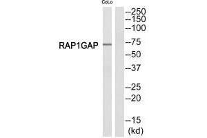 Western blot analysis of extracts from COLO205 cells, using RAP1GDS1 antibody. (RAP1GAP anticorps  (C-Term))