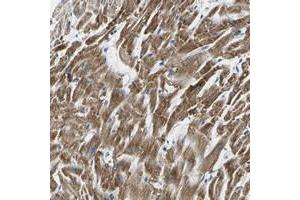 Immunohistochemical staining of human heart muscle with TMEM204 polyclonal antibody  shows strong cytoplasmic positivity in myocytes. (TMEM204 anticorps)
