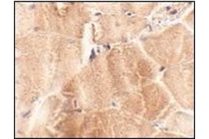 Immunohistochemistry of JPH2 in mouse skeletal muscle tissue with this product at 2. (Junctophilin 2 anticorps  (C-Term))