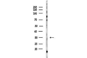 Western blot analysis of lysates from PC12 cells(starvation,24h treatment), using TNAP1 Antibody at 1/1000 dilution.
