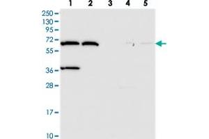 Western blot analysis of Lane 1: RT-4, Lane 2: U-251 MG, Lane 3: Human Plasma, Lane 4: Liver, Lane 5: Tonsil with ADAMTSL5 polyclonal antibody .