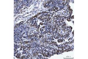 IHC analysis of Lamin A+C/LMNA using anti-Lamin A+C/LMNA antibody (ABIN7601843). (Lamin A/C anticorps  (AA 481-646))