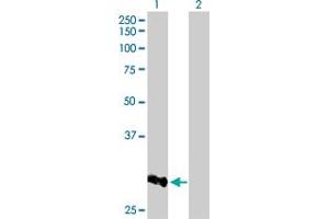 Western Blot analysis of CCNB1IP1 expression in transfected 293T cell line by CCNB1IP1 MaxPab polyclonal antibody. (CCNB1IP1 anticorps  (AA 1-277))