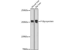 Western blot analysis of extracts of various cell lines, using P Glycoprotein antibody (ABIN6134228, ABIN6136339, ABIN6136342 and ABIN6215442) at 1:1000 dilution.