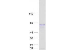 Validation with Western Blot