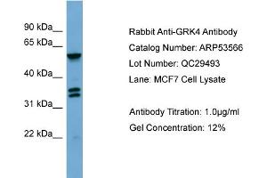 WB Suggested Anti-GRK4  Antibody Titration: 0. (GRK4 anticorps  (Middle Region))