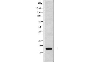 Western blot analysis of CKLF using Jurkat whole cell lysates (CKLF anticorps  (C-Term))