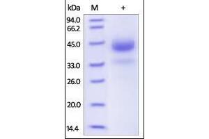 Cathepsin B (CTSB) (AA 18-339) protein (His tag)
