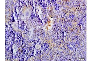 Formalin-fixed and paraffin embedded rat spleen tissue labeled with Anti-5-HTT/SLC6A4 Polyclonal Antibody, Unconjugated (ABIN735983) at 1:200 followed by conjugation to the secondary antibody and DAB staining (SLC6A4 anticorps  (AA 401-500))