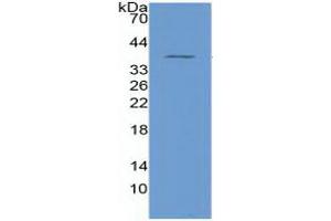 WB of Protein Standard: different control antibodies  against Highly purified E. (NFkB Kit ELISA)