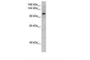 Image no. 1 for anti-PRP6 Pre-mRNA Processing Factor 6 Homolog (PRPF6) (AA 51-100) antibody (ABIN204965) (PRP6/ANT-1 anticorps  (AA 51-100))
