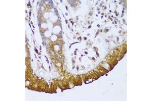 Immunohistochemistry of paraffin-embedded human colon using GCC2 antibody (ABIN6130422, ABIN6141007, ABIN6141008 and ABIN6217941) at dilution of 1:150 (40x lens).