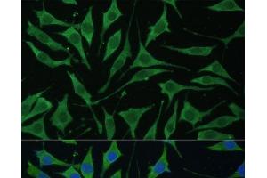 Immunofluorescence analysis of L929 cells using TIMM8B Polyclonal Antibody at dilution of 1:100 (40x lens).