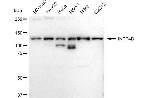 Western blotting analysis using INPP4B antibody (ABIN7799043).