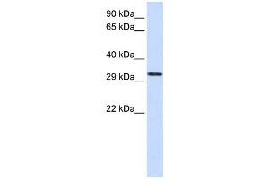 Western Blotting (WB) image for anti-Chromosome 21 Open Reading Frame 2 (C21orf2) antibody (ABIN2458962) (C21orf2 anticorps)