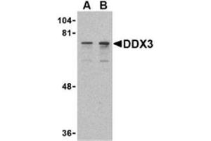 Western blot analysis of DDX3 in HepG2 cell lysate with AP30282PU-N DDX3 antibody at (A) 0. (DDX3X anticorps  (N-Term))
