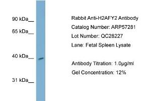 WB Suggested Anti-H2AFY2  Antibody Titration: 0. (H2AFY2 anticorps  (Middle Region))