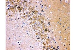 IHC-P testing of rat brain tissue (Glutamate Receptor 1 anticorps  (AA 19-360))