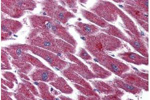 anti-Lysophosphatidic Acid Receptor 3 (LPAR3) (Internal Region) antibody