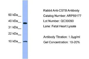 WB Suggested Anti-CSTB  Antibody Titration: 0.