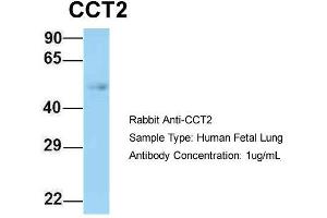 Host: Rabbit  Target Name: CCT2  Sample Tissue: Human Fetal Lung  Antibody Dilution: 1. (CCT2 anticorps  (N-Term))
