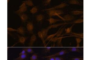 Immunofluorescence analysis of C6 cells using TIMP2 Polyclonal Antibody at dilution of 1:100. (TIMP2 anticorps)