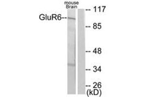 Western blot analysis of extracts from mouse brain cells, using mGluR6 Antibody.
