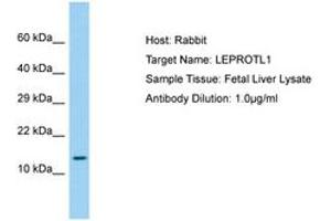 Image no. 1 for anti-Leptin Receptor Overlapping Transcript-Like 1 (LEPROTL1) (AA 37-86) antibody (ABIN6750210) (LEPROTL1 anticorps  (AA 37-86))
