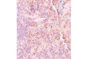 Immunohistochemical staining of rat spleen tissue with 5 ug/mL SQSTM1 polyclonal antibody . (SQSTM1 anticorps  (C-Term))
