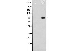 Western blot analysis of NF- kappaB p65 phosphorylation expression in TNF-α treated 293 whole cell lysates,The lane on the left is treated with the antigen-specific peptide.