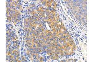 ABIN6258520 and ABIN6274742 at 1/100 staining Rat ovarian tissue by IHC-P. (MRPL44 anticorps)